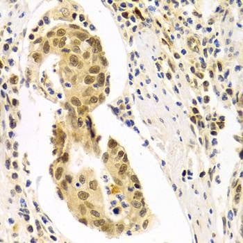 Anti-DLGAP5 Antibody
