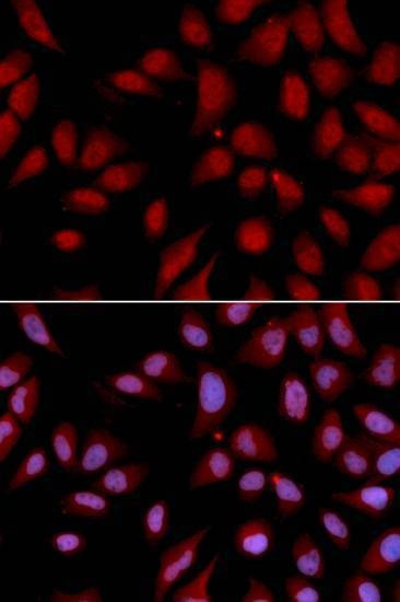 Anti-DLGAP5 Antibody