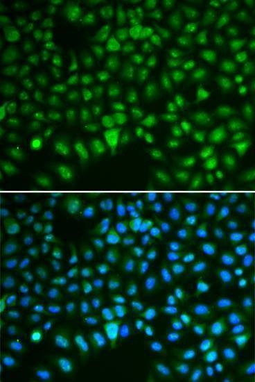 Anti-DLGAP5 Antibody
