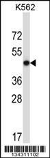 Anti-METAP2 (N-term) Antibody