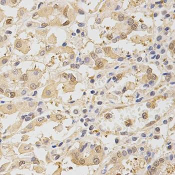 Anti-TOLLIP Antibody