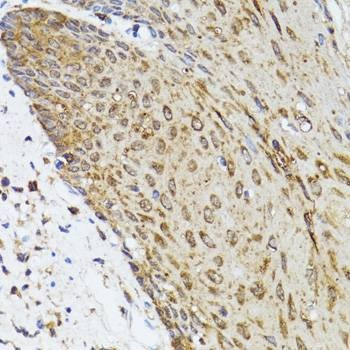 Anti-TOLLIP Antibody