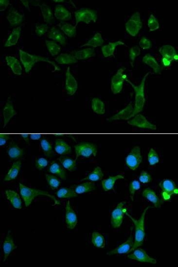 Anti-TOLLIP Antibody
