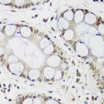 Anti-CBX3 Antibody