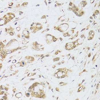 Anti-DMAP1 Antibody