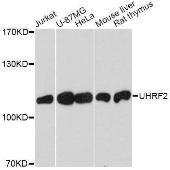 Anti-UHRF2 Antibody