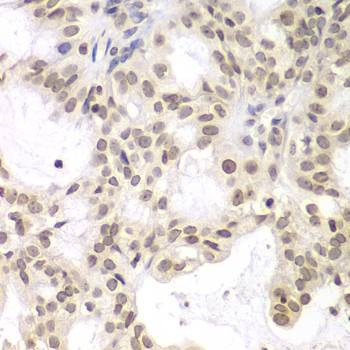 Anti-UHRF2 Antibody