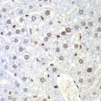 Anti-UHRF2 Antibody