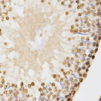 Anti-DiMethyl-Histone H3-K9 Antibody