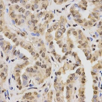 Anti-MonoMethyl-Histone H3-K27 Antibody