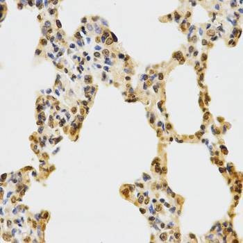 Anti-MonoMethyl-Histone H3-K27 Antibody