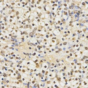 Anti-MonoMethyl-Histone H3-K27 Antibody