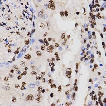 Anti-DiMethyl-Histone H3-K27 Antibody
