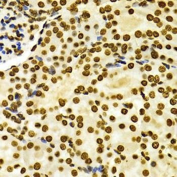 Anti-DiMethyl-Histone H3-K27 Antibody