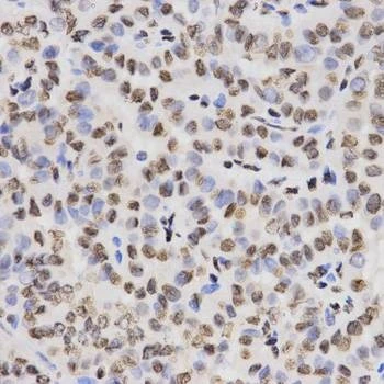 Anti-TriMethyl-Histone H3-K27 Antibody