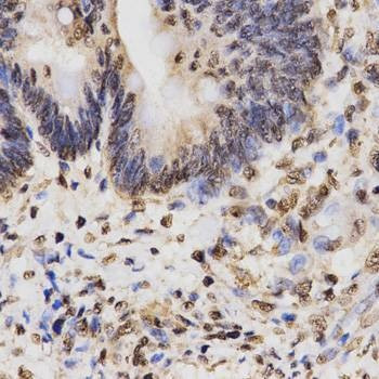 Anti-TriMethyl-Histone H3-K27 Antibody