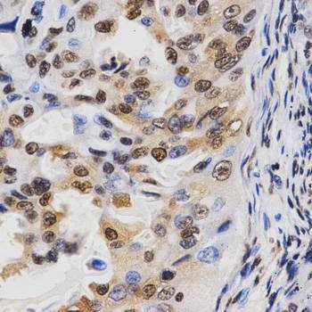 Anti-TriMethyl-Histone H3-K36 Antibody