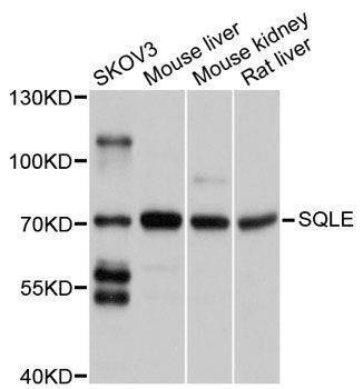 Anti-SQLE Antibody