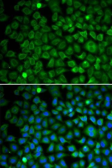 Anti-NUP62 Antibody