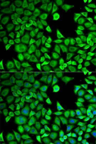 Anti-LTA4H Antibody