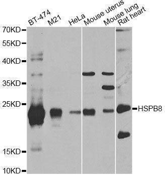 Anti-HSPB8 Antibody