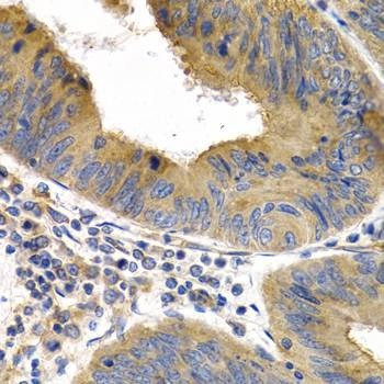 Anti-HSPB8 Antibody
