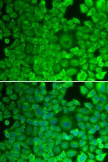 Anti-GYS1 Antibody