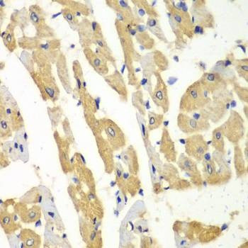 Anti-HNMT Antibody