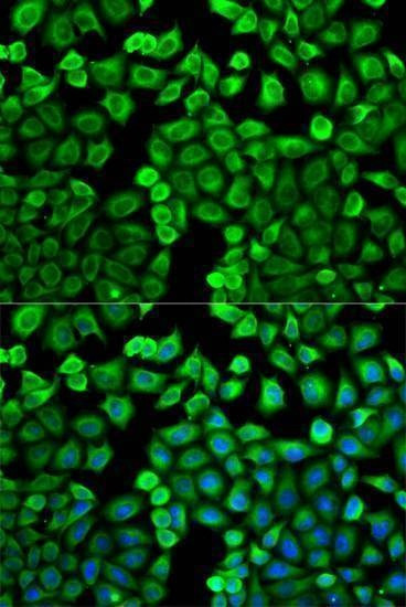 Anti-HNMT Antibody