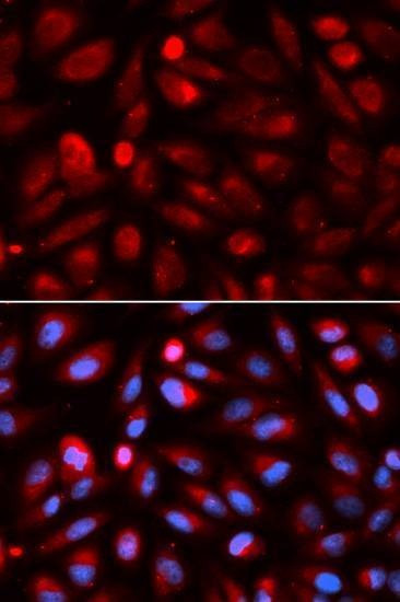 Anti-ACP5 Antibody