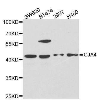 Anti-GJA4 Antibody