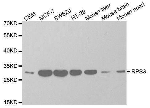 Anti-RPS3 Antibody