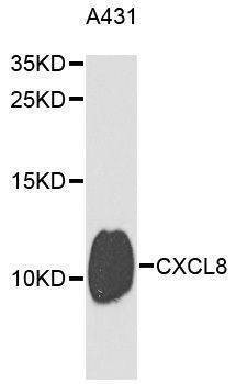 Anti-CXCL8 Antibody