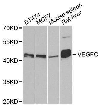 Anti-VEGFC Antibody