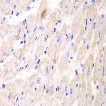 Anti-YWHAQ Antibody