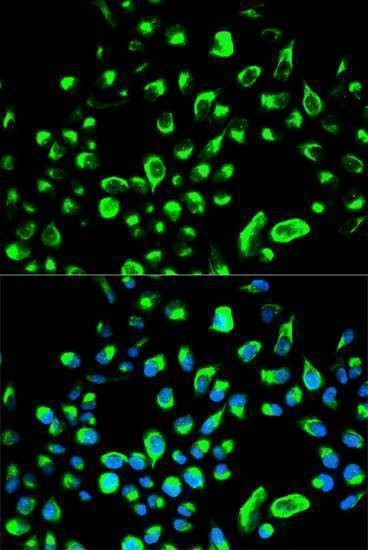 Anti-YWHAQ Antibody