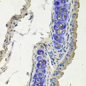 Anti-SKP1 Antibody
