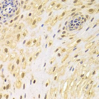 Anti-AIFM1 Antibody