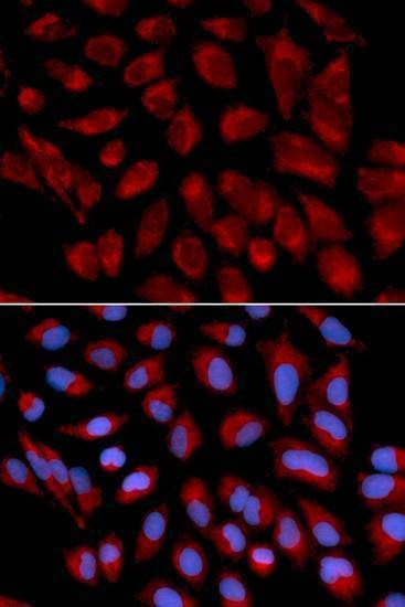 Anti-AIFM1 Antibody