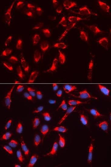 Anti-WASL Antibody