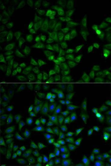 Anti-TPI1 Antibody