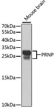 Anti-PRNP Antibody
