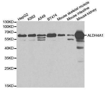Anti-ALDH4A1 Antibody