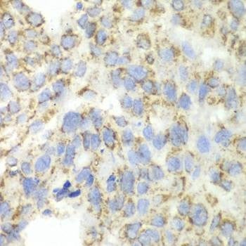Anti-ALDH4A1 Antibody