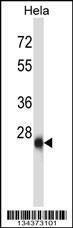 Anti-ZIC4 (N-term) Antibody