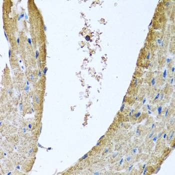 Anti-COX5B Antibody