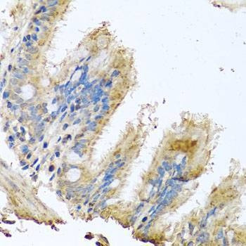 Anti-COX6B1 Antibody