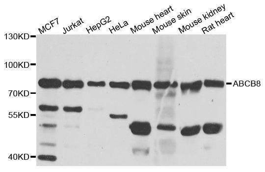 Anti-ABCB8 Antibody