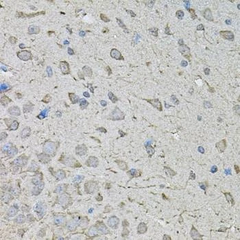 Anti-CDK10 Antibody