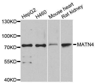 Anti-MATN4 Antibody